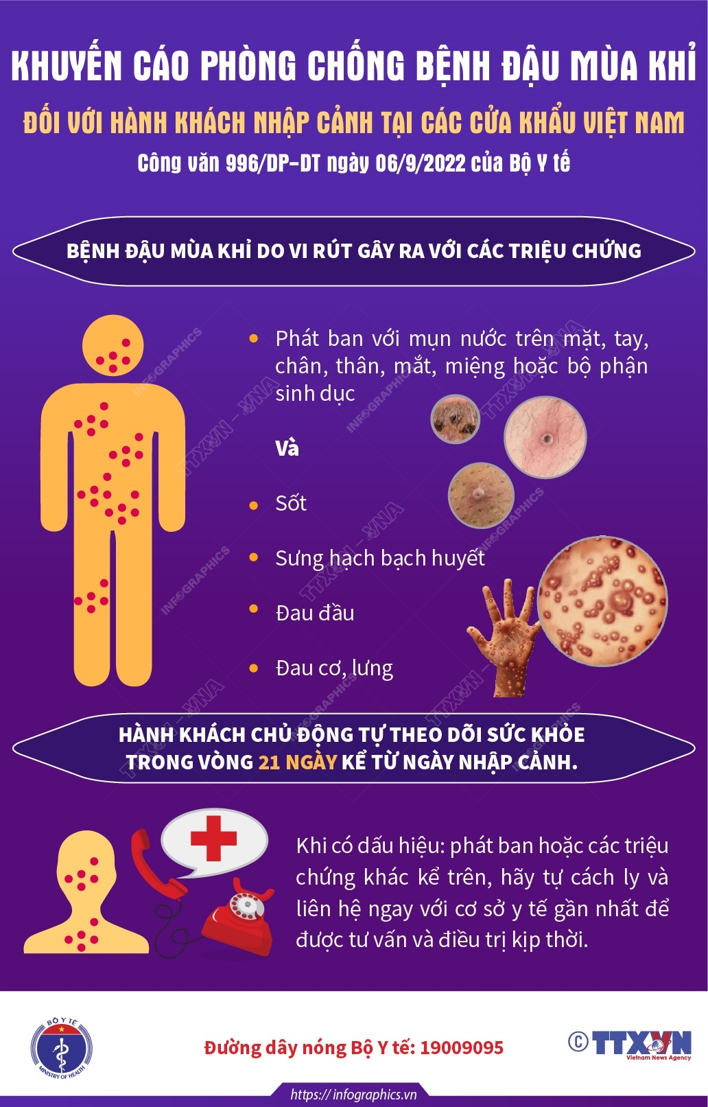 Bộ infographic: Khuyến cáo phòng chống bệnh đậu mùa khỉ đối với hành khách  nhập cảnh tại các cửa khẩu Việt Nam – CDC An Giang