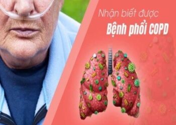BỆNH PHỔI TẮC NGHẼN MẠN TÍNH (COPD) VÀ CÁC DẤU HIỆU NHẬN BIẾT SỚM