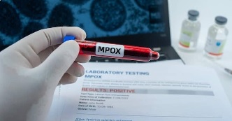 TP HCM thêm 6 ca đậu mùa khỉ