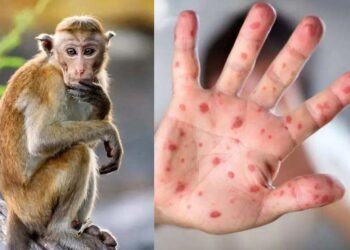 Sở Y tế tỉnh An Giang: Tăng cường phòng, chống bệnh Đậu mùa khỉ trong tình hình mới