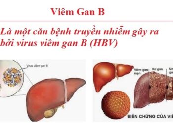Phòng bệnh viêm gan do vi rút