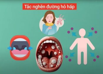 An Giang tăng cường công tác phòng, chống bệnh bạch hầu