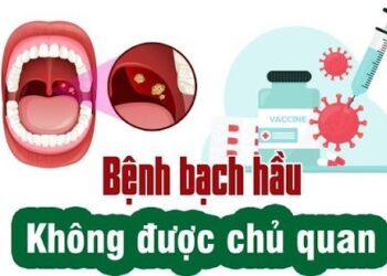 Biểu hiện và cách phòng bệnh bạch hầu