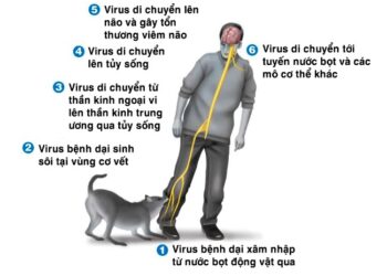 Bệnh dại không thể chủ quan