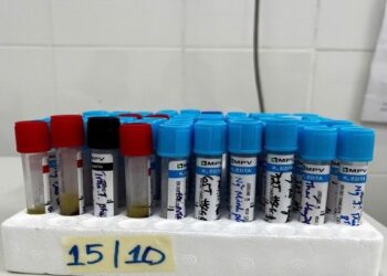 Những điều cần biết về Xét nghiệm máu