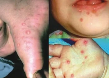 Phú Tân chủ Động Phòng, chống  bệnh Tay chân miệng