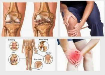 Bệnh Thấp khớp và mùa lạnh – Cách Phòng ngừa