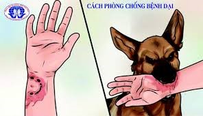 Bệnh Dại: nguy cơ tử vong cao nếu không phòng ngừa kịp thời