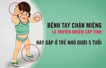 TV-Spot: Khuyến Cáo phòng bệnh Tay-Chân-Miệng