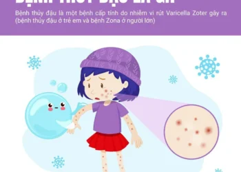 Thủy đậu lây lan mạnh theo mùa lạnh: Cần chủ động tiêm phòng và xử trí đúng cách
