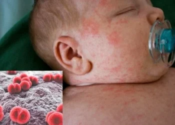 Chủ động phòng bệnh Viêm Não Mô Cầu – đừng chủ quan