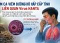 Cập nhật thông tin về chùm ca viêm đường hô hấp cấp tính liên quan vi rút Hanta