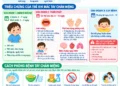Sốt xuất huyết và cách phòng bệnh