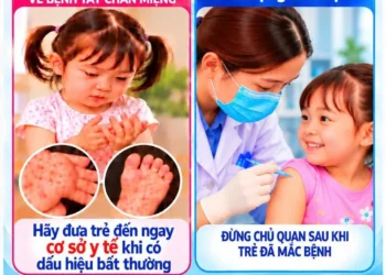 Infographic – Phòng bệnh Tay Chân Miệng