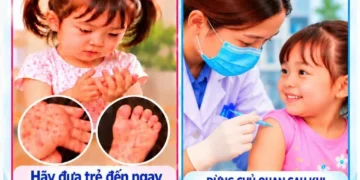 Infographic – Phòng bệnh Tay Chân Miệng