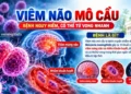 Video – Viêm não mô cầu, bệnh nguy hiểm có thể tử vong nhanh